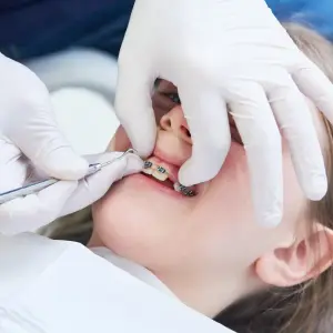 Young patient receiving braces care with Dr. Firas Hamzeh